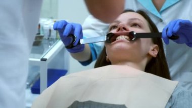 Diş hekimi, dişçilikte tedaviden önce kadın dişlerinin fotoğraflarını çekiyor. Diş hekimliğinde ortodontik tedavi, diş protezi. Kaplama takmadan önce dişleri....