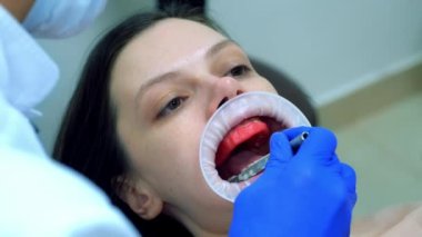 Ortodontist kadın hasta dişlerinin metal kısmını onarıyor. Kondilografiye hazırlanıyor. Alt çene eklemlerinin incelenmesi ve tedavisi. Ortodontoloji tedavisi ve tedavi konsepti. Diş hekimliği ve kliniği.
