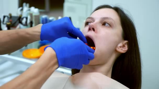 Οδοντίατρος Λάβει Καλούπι Οδοντοστοιχίας Από Τις Γυναίκες Κάτω Γνάθου Για — Αρχείο Βίντεο