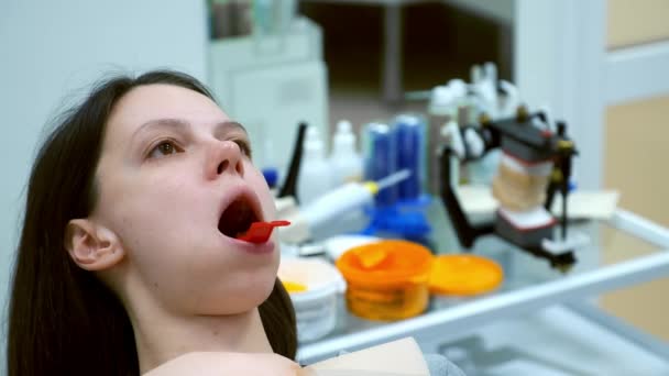 Женщина Зубной Плесенью Отпечаток Нижней Челюсти Стоматологии Создания Протеза Ортодонтическое — стоковое видео