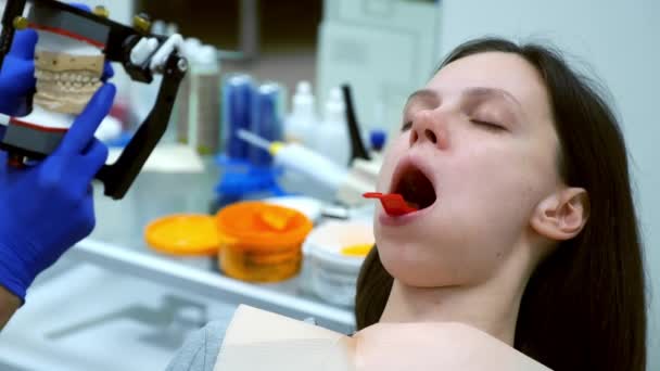 Mulher Com Impressão Molde Dentário Mandíbula Inferior Odontologia Para Criar — Vídeo de Stock