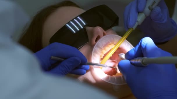 Стоматолог Готує Жіночі Зуби Установки Керамічних Вінірів Коронок Допомогою Дрилі — стокове відео