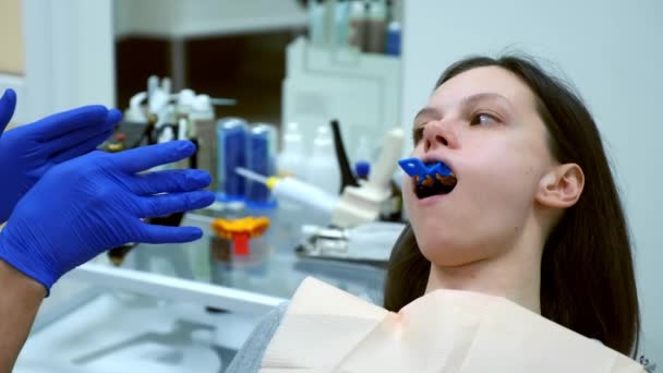 Γυναίκα Την Οδοντοστοιχία Αποτύπωμα Μούχλας Στην Άνω Γνάθο Στην Οδοντιατρική — Αρχείο Βίντεο