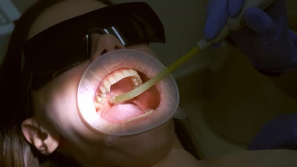 Zahnarzt Sammelt Speichel Mit Einem Speichelauswurf Der Mundhöhle Der Frau — Stockvideo