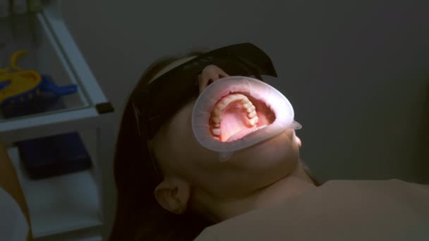 牙科医生正在准备妇女的牙齿 以安装陶瓷镶面和牙冠去除釉质 假肢的概念 牙齿矫正师的治疗 — 图库视频影像