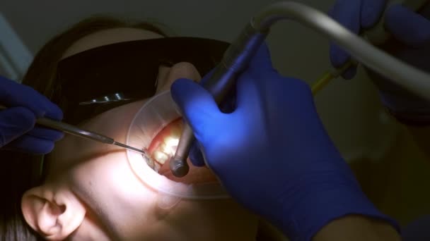 牙科医生正在准备妇女的牙齿 以便用钻头安装陶瓷饰物和牙冠 他正在部分去除牙齿上的牙釉质 假肢的概念 牙齿矫正师的治疗 — 图库视频影像