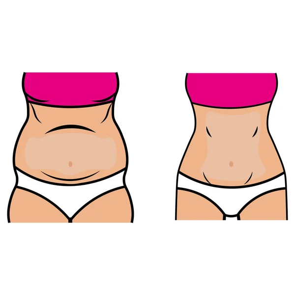 Female Body Slimming Icon Vector Illustration Symbol — Stock Vector