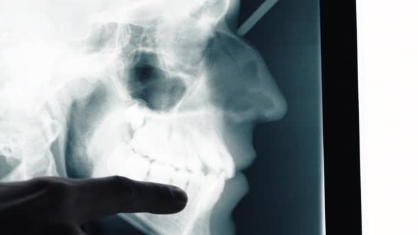 Κοντινό Πλάνο Του Doctor Hand Dental Ray — Αρχείο Βίντεο