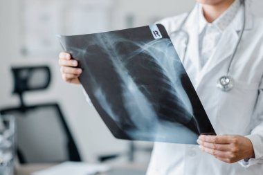 Beyaz önlüklü bir sağlık uzmanı modern bir tıbbi tesiste göğüs röntgeni çekiyor ve hastanın teşhisi ve bakımı üzerinde çalışıyor..