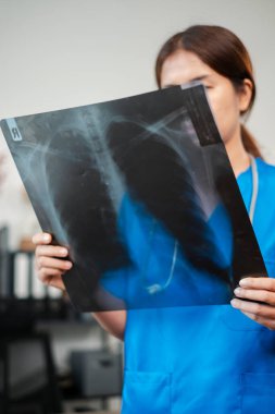 Bir sağlık çalışanı, klinik ortamda hastanın teşhisine ve tıbbi analizine odaklanan bir göğüs röntgeni inceler..
