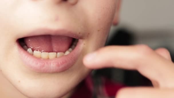 Chłopak Dotyka Trzęsie Palcami Krzywy Ząb Mleczny Zbliżenie Makro Ujęcia — Wideo stockowe