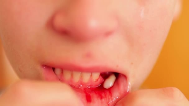 Ein Weinender Junge Hause Der Badezimmer Einen Lockeren Zahn Zieht — Stockvideo