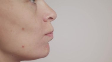 Beyaz burun derisi yüzünden burnu ve burnu olan bir kadın. Genç bir kadın yüzüne bakar..