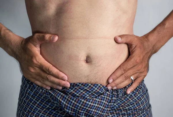 Buik Van Zuidoost Aziatische Man Concept Van Centrale Obesitas Buikvet — Stockfoto