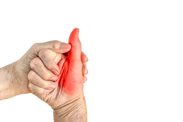 老年人痛苦的拇指和肌肉 与白种人隔离 — 图库照片