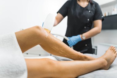 Vücut kıllarını çıkarmanın modern yolları. Lazer tüy aldırma. Kapalı çekimde beyaz bir insanın bacaklarını SPA yatağında yatarken gösteriyor. Bir bacağı özel jelle kaplıdır. Siyahta bulanık uzman