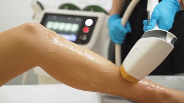 Procedimento Cosmetologia Remoção Cabelo Epilação Laser Cosmetologia Mulheres Caucasianas Irreconhecíveis — Vídeo de Stock