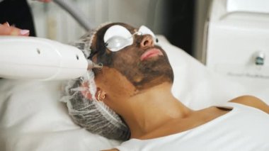SPA ve estetik tıp konsepti. Siyah üniformalı tanınmayan estetisyen, renk değişimi tedavisi için profesyonel lazer kullanıyor. Arka plan bulanık. Yüksek kalite 4k görüntü