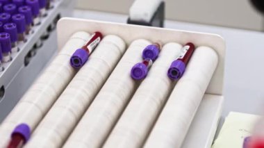 Four blood samples being agitated on centrifuge. Other samples are placed in test tube holder. Blurred foreground. High quality 4k footage