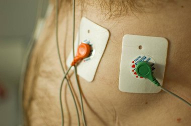 EKG ya da EKG testi.