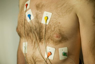 EKG ya da EKG testi.