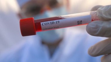 Koruyucu eldivenli bir doktorun eli COVID-19 virüsüne kan örneği test ediyor. Coronavirus 'a kan örneği taşıyan test tüpünü tutan sıhhiye kolu. Salgından korunan sağlık ve güvenlik kavramı. Kapat.