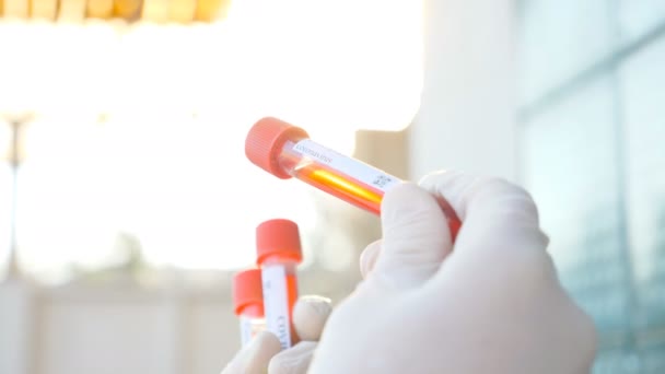 Probówki Próbkami Krwi Koronawirusa Ręce Lekarza Lub Pracownika Laboratorium Ramię — Wideo stockowe