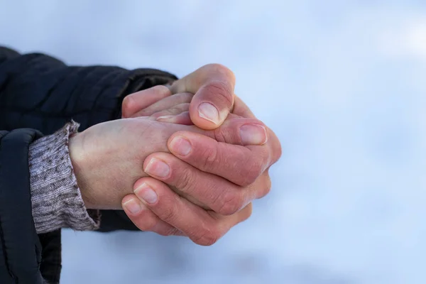 Red hands in the cold.Risk of frostbite of hand or fingers outdoors during cold weather because of frost in winter.