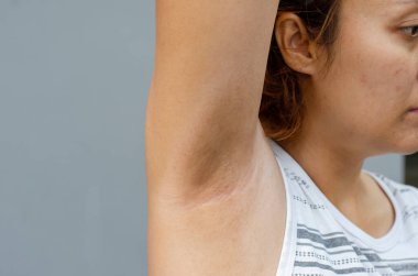 Genç Asyalı kadın elini kaldırıp karanlık ya da donuk koltuk altlarını, sağlık hizmetleri konseptini gösteriyor.