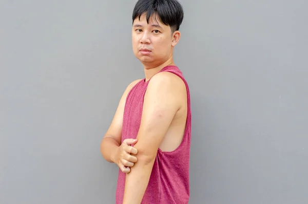 Hombre Asiático Rascarse Picazón Con Mano Área Del Codo Concepto — Foto de Stock