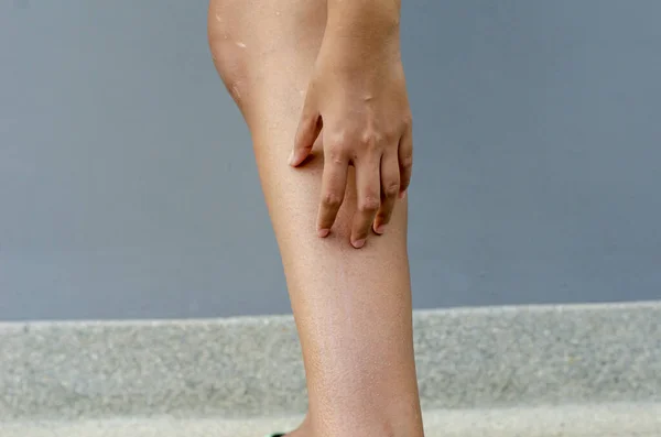 Genç Asyalı Bir Kadın Elini Bacağına Sürterek Kaşınıyor Sağlık Konsepti — Stok fotoğraf