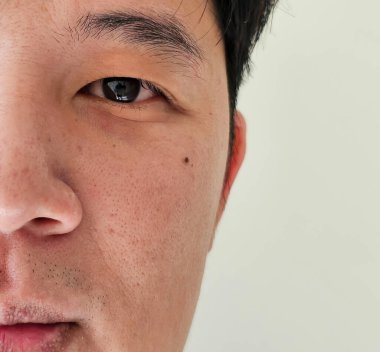 Gözün altındaki siyah ben, Asyalı erkek yüzü, fizyonomi konsepti.