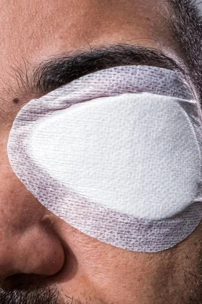 Occhio Dell Uomo Adulto Coperto Intonaco Bianco Dopo Intervento Chirurgico — Foto Stock