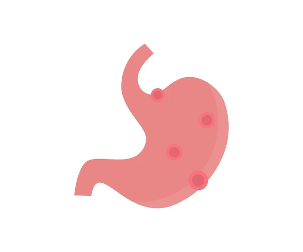 因胃痛 胃溃疡 阑尾炎或胃肠道系统疾病而引起的胃痛痛苦 保健和健康保险概念载体的设计和说明 — 图库矢量图片