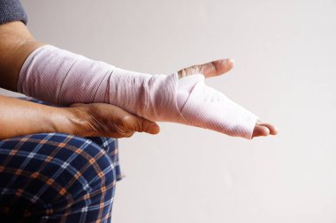 Bileği burkulmuş bandajla sarılı bir el, yaralanmış kol tedavisi. Kavram, sağlık sorunu, kaza, ilk yardım. Sigorta..              
