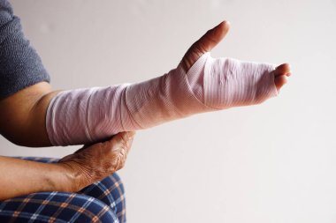 Bileği burkulmuş bandajla sarılı bir el, yaralanmış kol tedavisi. Kavram, sağlık sorunu, kaza, ilk yardım. Sigorta..       