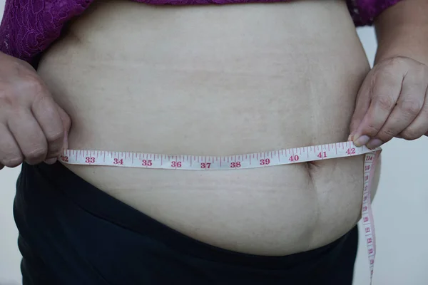 Closeup woman hands measure her big belly, fat with cellulite abdomen by using measuring tape. Concept, obesity. Overweight. Body shape problem for woman after pregnancy or getting older.