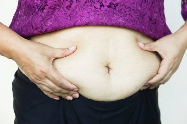 Kapalı kadın elleri büyük göbeğe dokunur, selüloit karın boşluğu ile şişmanlar. Kavram, obezite. Fazla kilolu. Hamilelikten sonra ya da yaşlandıktan sonra kadınlar için vücut şekli sorunu. Sağlık hizmetleri.   