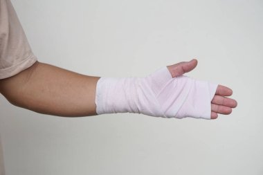 Bileği burkulmuş bandajla sarılı bir el, yaralanmış kol tedavisi. Kavram, sağlık sorunu, kaza, ilk yardım. Sigorta..         
