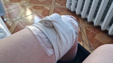 Elektroterapi. Diz ekleminin atımlı elektrik akımıyla tedavi edilmesi. Kas aktivitesini uyarmak ve acıyı azaltmak için elektrik akımının kullanımına dayalı yaraların tedavisi