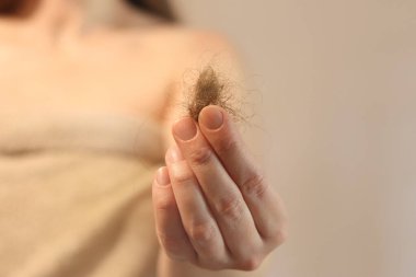 Kız, düşmüş saçlarını yakından tutuyor. Saç dökülmesi konsepti, saç dökülmesi. Saç bakımı. Havlu giymiş genç bir kadın, dökülen saç miktarlarını inceler, birbirine dolanır. Vitamin eksikliği