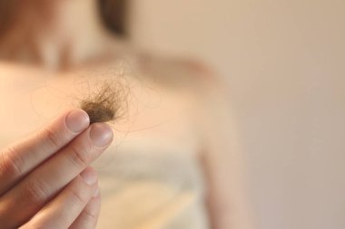 Kız, düşmüş saçlarını yakından tutuyor. Saç dökülmesi konsepti, saç dökülmesi. Saç bakımı. Havlu giymiş genç bir kadın, dökülen saç miktarlarını inceler, birbirine dolanır. Vitamin eksikliği