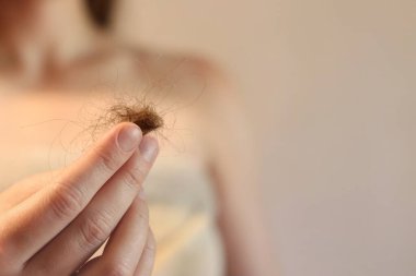Kız, düşmüş saçlarını yakından tutuyor. Saç dökülmesi konsepti, saç dökülmesi. Saç bakımı. Havlu giymiş genç bir kadın, dökülen saç miktarlarını inceler, birbirine dolanır. Vitamin eksikliği