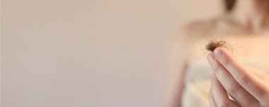 Kız, düşmüş saçlarını yakından tutuyor. Saç dökülmesi konsepti, saç dökülmesi. Saç bakımı. Havlu giymiş genç bir kadın, dökülen saç miktarlarını inceler, birbirine dolanır. Vitamin eksikliği