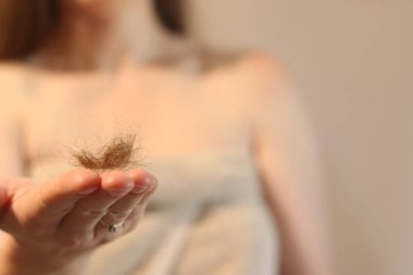 Kız, düşmüş saçlarını yakından tutuyor. Saç dökülmesi konsepti, saç dökülmesi. Saç bakımı. Havlu giymiş genç bir kadın, dökülen saç miktarlarını inceler, birbirine dolanır. Vitamin eksikliği