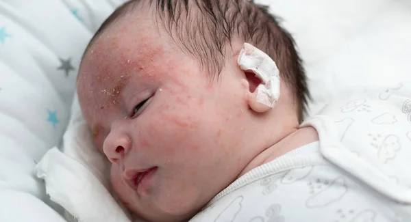 Bayi Lucu Yang Baru Lahir Dengan Obat Telinganya Tema Medis — Stok Foto