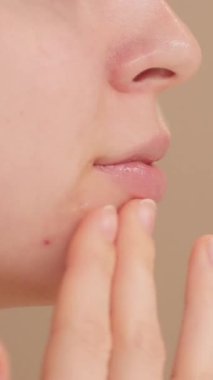 Sivilce önleyici serumu çene bölgesine uygulayan genç bir kadının yakın çekimi. Sivilce tedavisi. Kusurlu tedavi ve kişisel bakım. Küçük kız ağır çekimde yüz serumu uyguluyor..