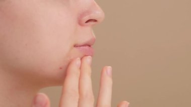 Sivilce önleyici serumu çene bölgesine uygulayan genç bir kadın. Sivilce tedavisi. Kusurlu tedavi ve kişisel bakım. Açık bej arka planda stüdyoda yüz serumu uygulayan genç bir kız..
