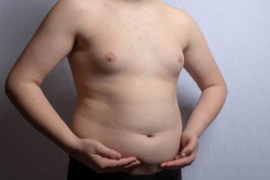 Ayakta dururken karnını gösteren kilolu beyaz bir çocuk.