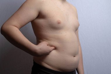 Ayakta dururken karnını gösteren kilolu beyaz bir çocuk.